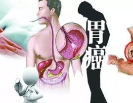 小姐姐确诊胃癌,小姐姐勇敢面对病魔挑战